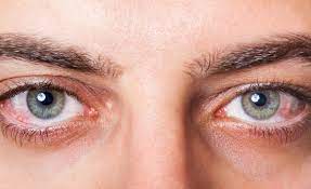 How To Get Relief From Dry Eyes And Improve Your Vision – Visit Dry Eye Clinic Calgary