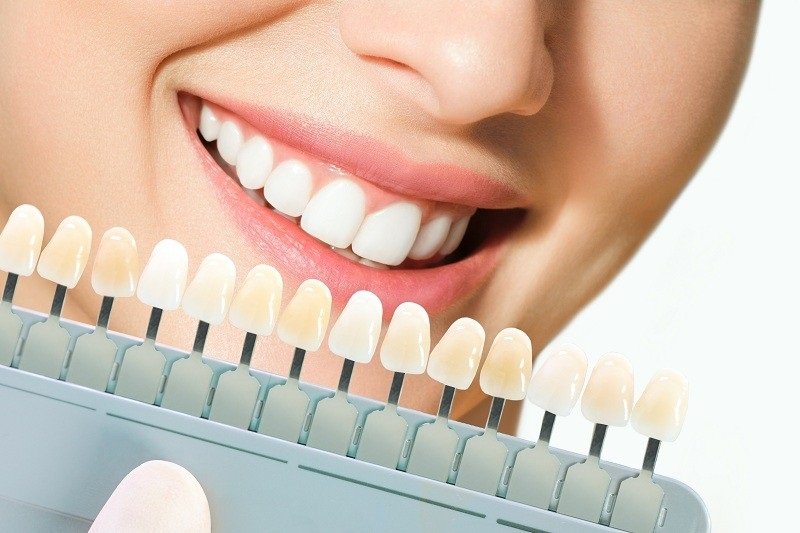 Unveiling the Advantages: How the Best Cosmetic Dentists in Turkey Are Transforming Smiles