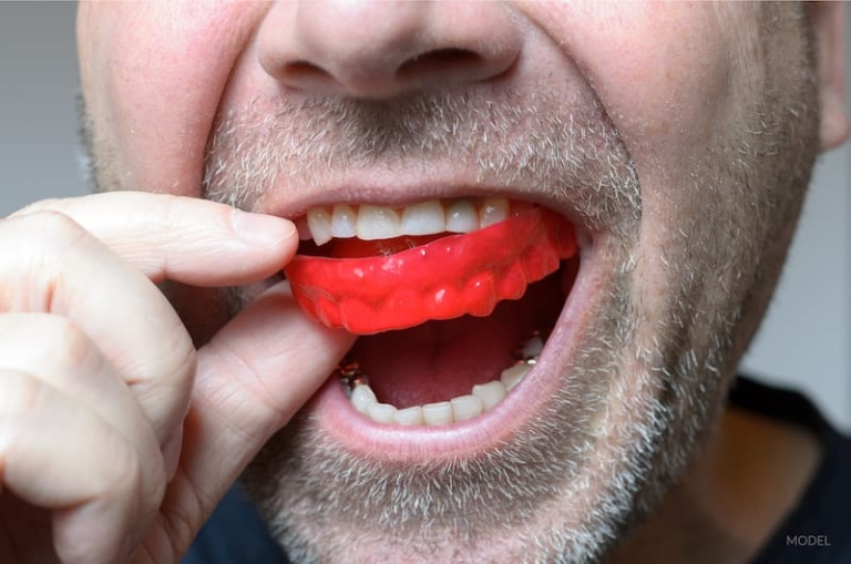 Benefits of Having a Mouth Guard - UR Health Info