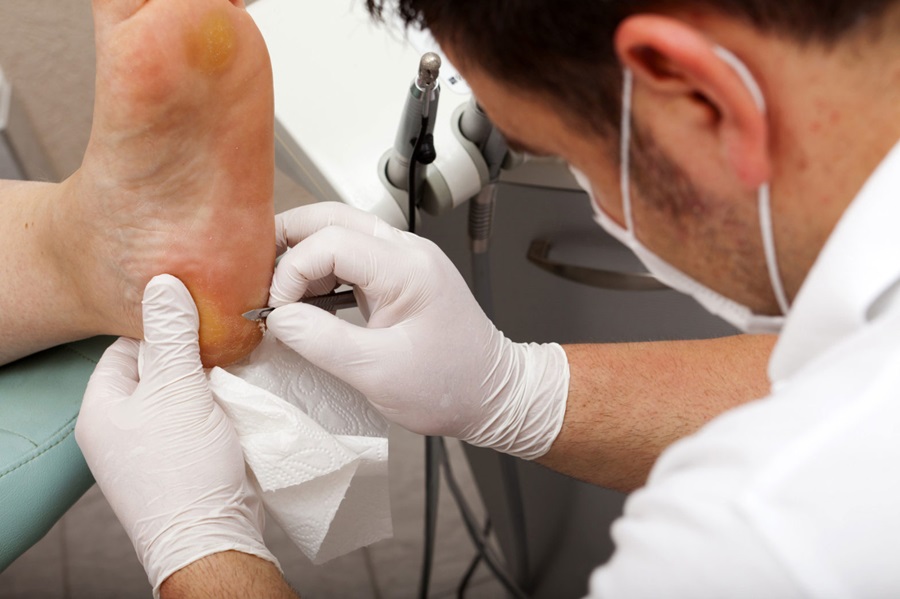 The Role Of Podiatrists In Wound Care